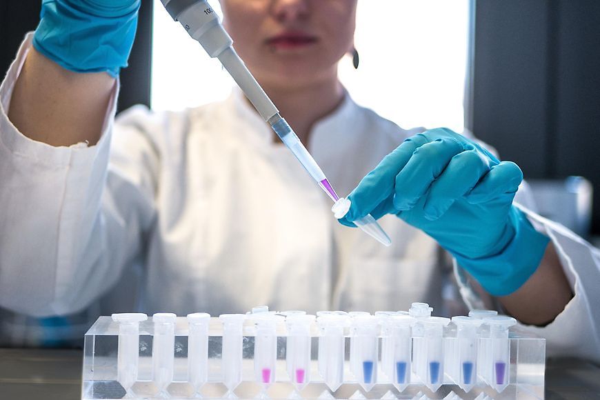 Frau arbeitet am im Labor und befüllt mit einer Pipette Röhrchen